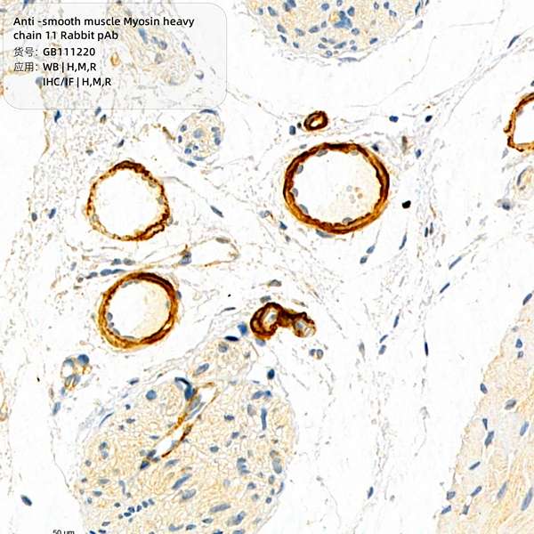 Антитела первичные, поликлональные, smooth muscle Myosin heavy chain 11, 100 мкл