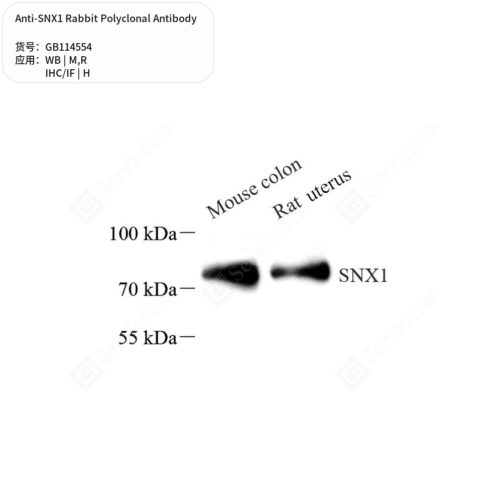 Антитела первичные, поликлональные кролика к SNX1 крысы, мыши, человека, 100 мкл