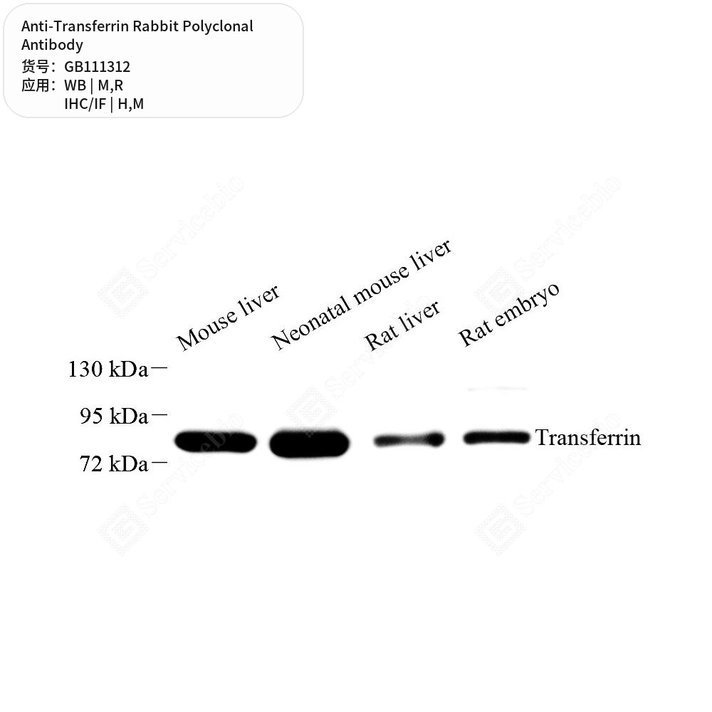 Антитела первичные, поликлональные кролика к Transferrin крысы, мыши, человека, 100 мкл