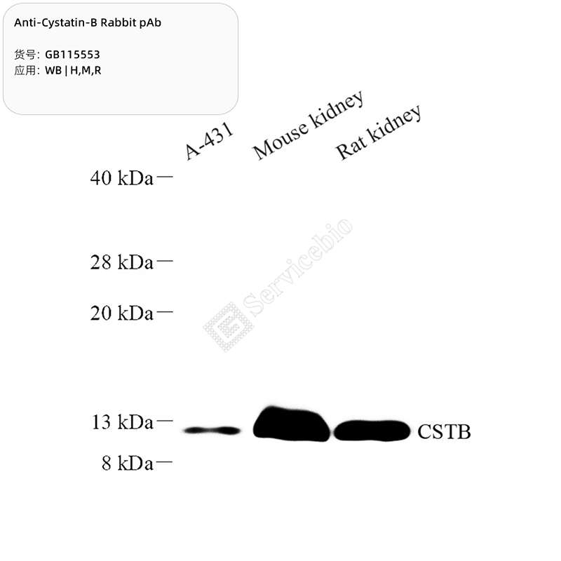 Антитела первичные, поликлональные, Cystatin-B, 100 мкл