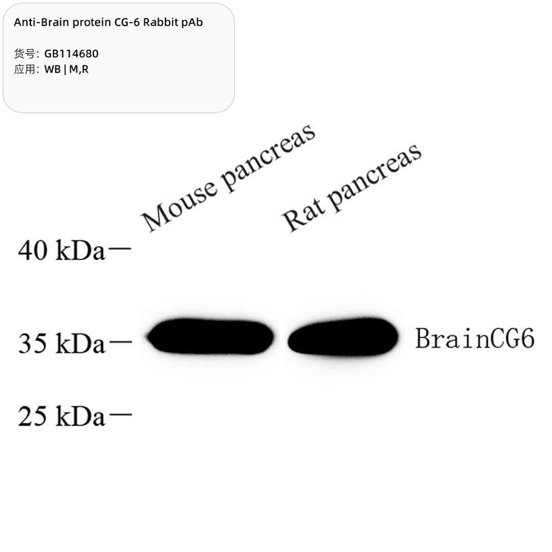Антитела первичные, поликлональные, BrainCG6, 100 мкл