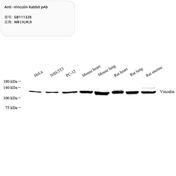Антитела первичные, поликлональные, Vinculin, 100 мкл