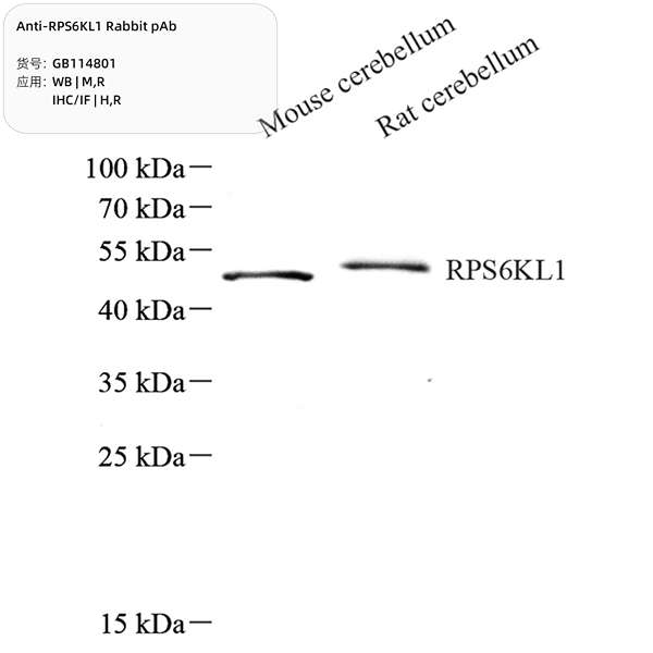 Антитела первичные, поликлональные, RPS6KL1, 100 мкл