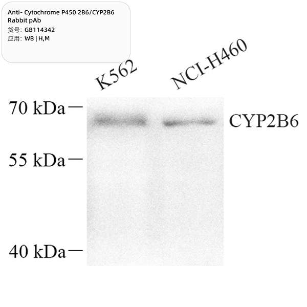 Антитела первичные, поликлональные, Cytochrome P450 2B6/CYP2B6, 100 мкл