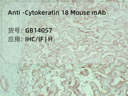 Антитела первичные, моноклональные мыши к Cytokeratin 18 человека, 50 мкл
