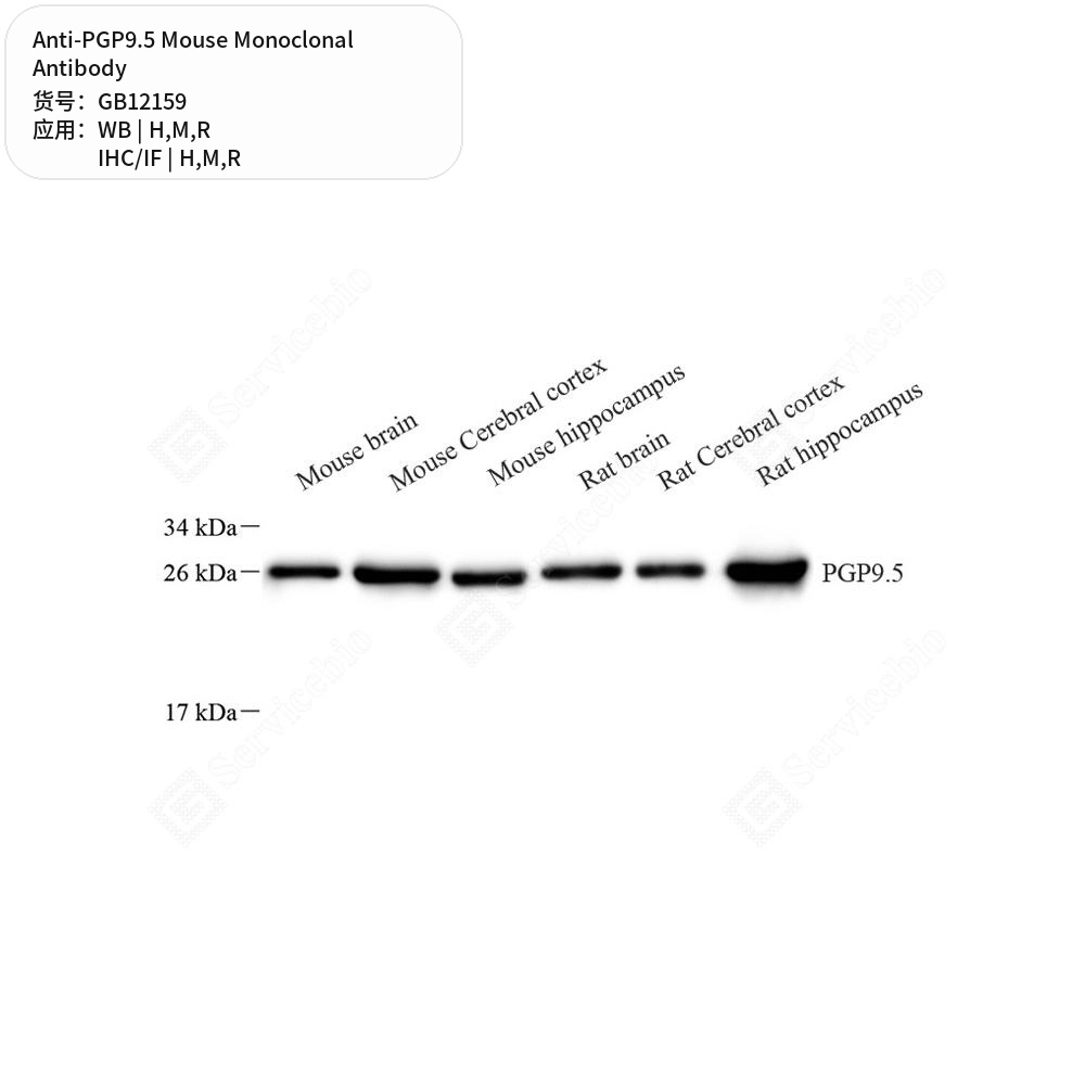 Антитела первичные, моноклональные мыши к PGP9.5 крысы, мыши, человека, 100 мкл