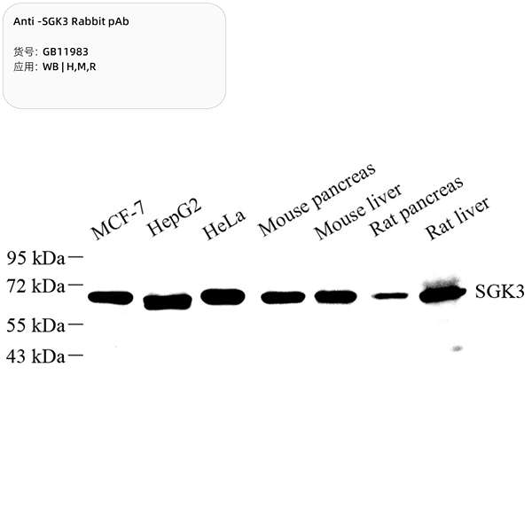 Антитела первичные, поликлональные, SGK3, 100 мкл