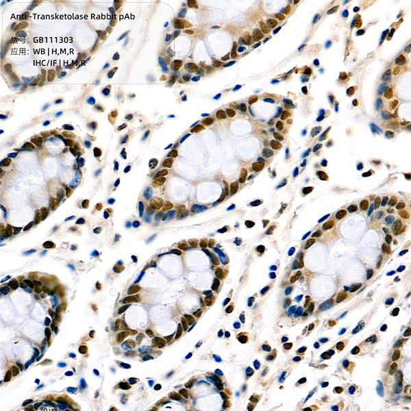 Антитела первичные, поликлональные, Transketolase, 100 мкл