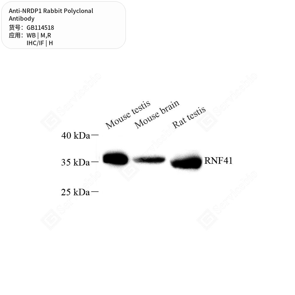 Антитела первичные, поликлональные кролика к NRDP1 крысы, мыши, человека, 50 мкл