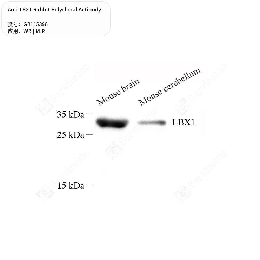 Антитела первичные, поликлональные кролика к LBX1 крысы, мыши, 50 мкл