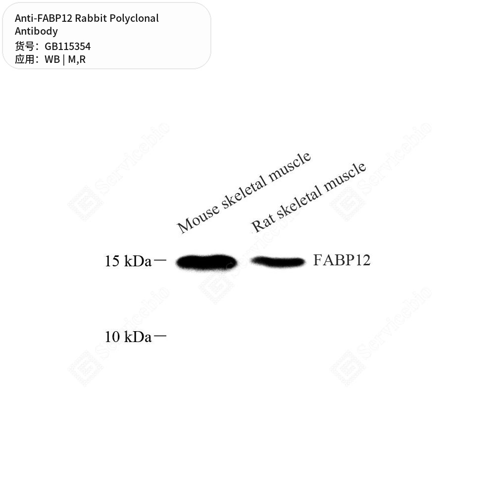 Антитела первичные, поликлональные кролика к FABP12 крысы, мыши, 50 мкл