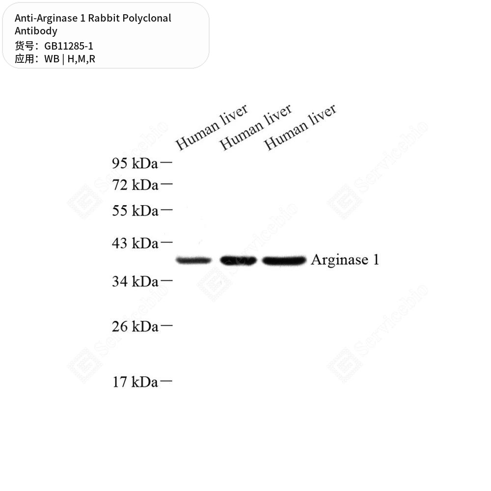 Антитела первичные, поликлональные кролика к Arginase 1 крысы, мыши, человека, 100 мкл