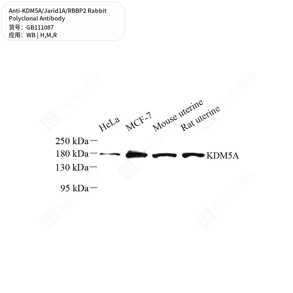 Антитела первичные, поликлональные кролика к KDM5A/Jarid1A/RBBP2 крысы, мыши, человека, 100 мкл
