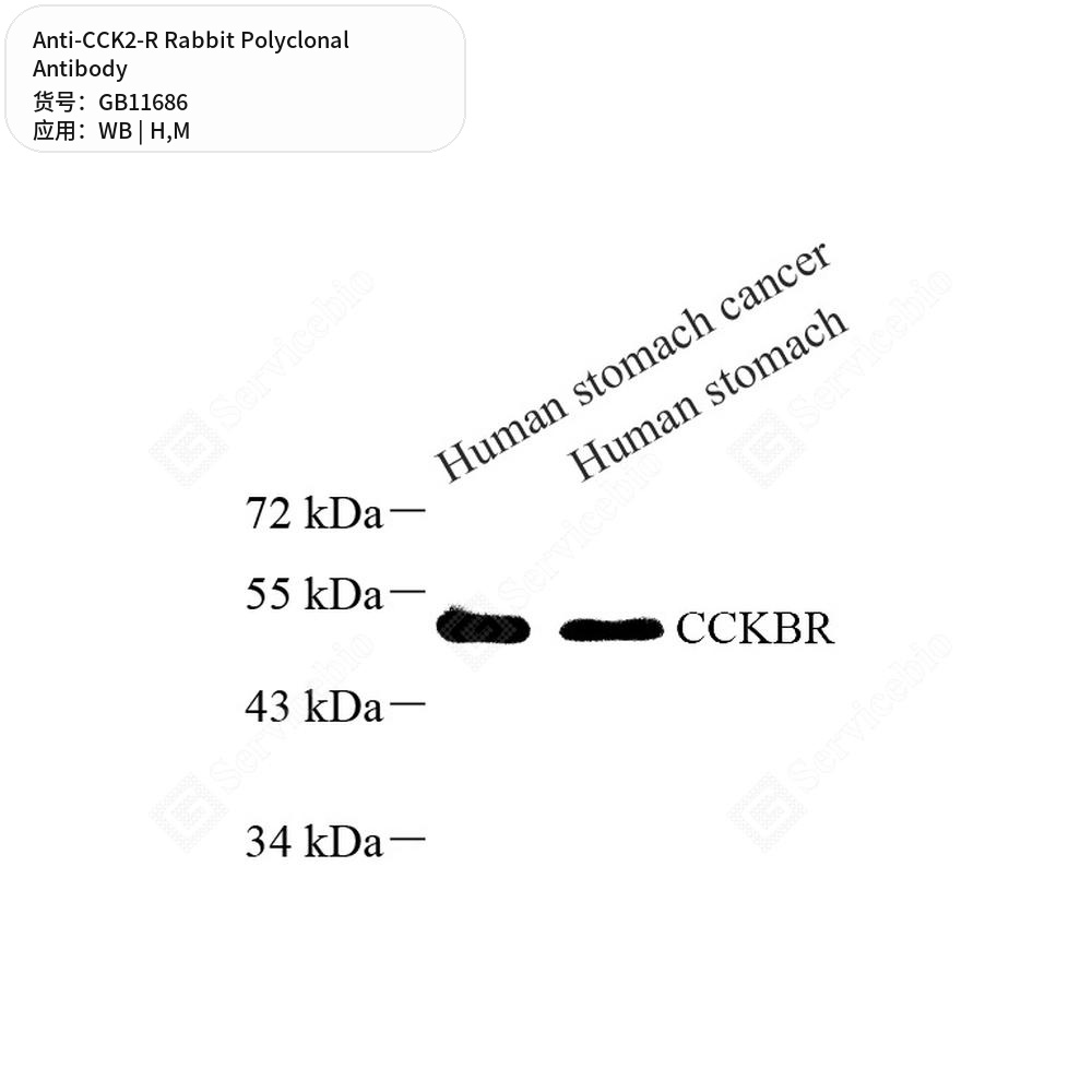 Антитела первичные, поликлональные кролика к CCK2-R мыши, человека, 50 мкл