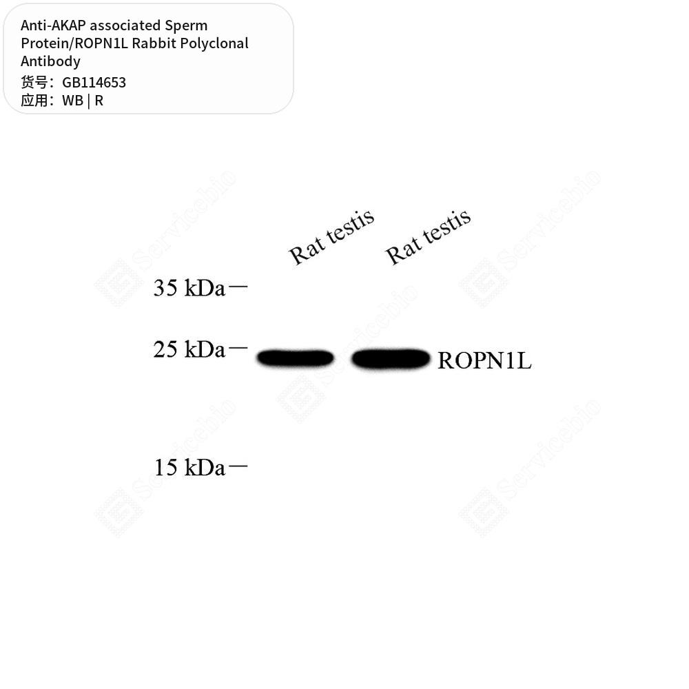 Антитела первичные, поликлональные кролика к AKAP associated Sperm Protein/ROPN1L крысы, 50 мкл