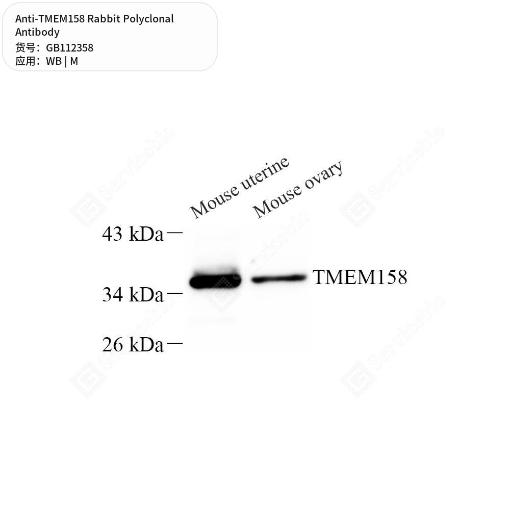Антитела первичные, поликлональные кролика к TMEM158 мыши, 100 мкл