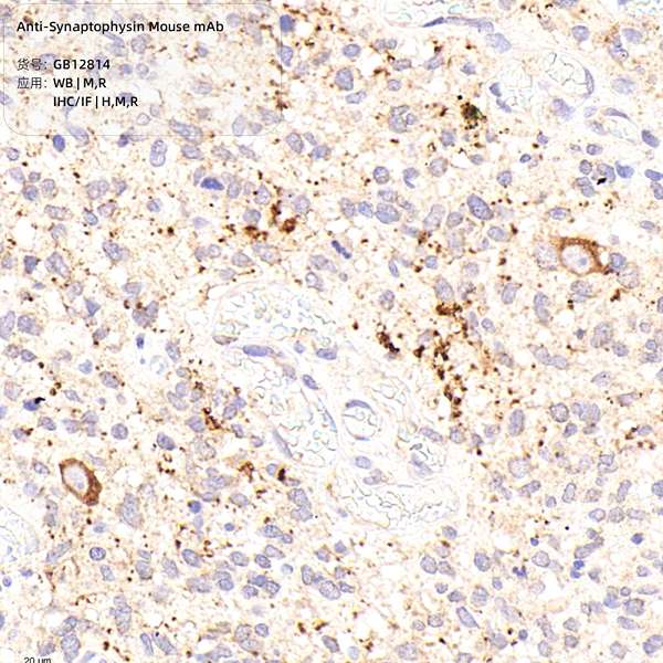 Антитела первичные, моноклональные, Synaptophysin, 100 мкл