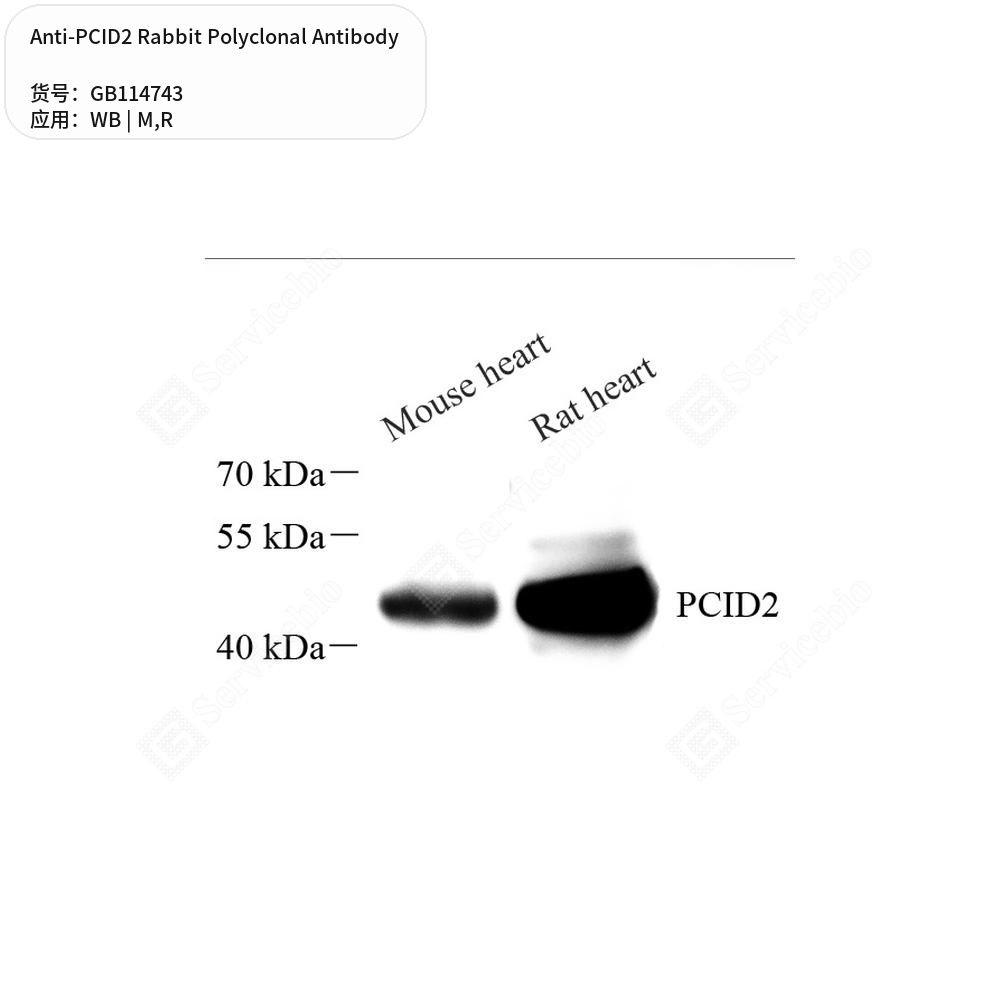 Антитела первичные, поликлональные кролика к PCID2 крысы, мыши, 50 мкл