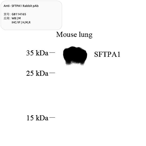 Антитела первичные, поликлональные, SFTPA1, 100 мкл