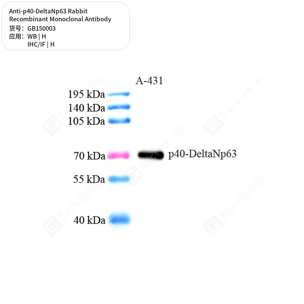 Антитела первичные, моноклональные кролика к p40-DeltaNp63 человека, 50 мкл