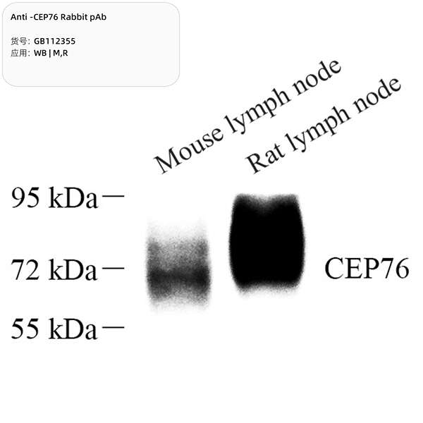 Антитела первичные, поликлональные, CEP76, 100 мкл