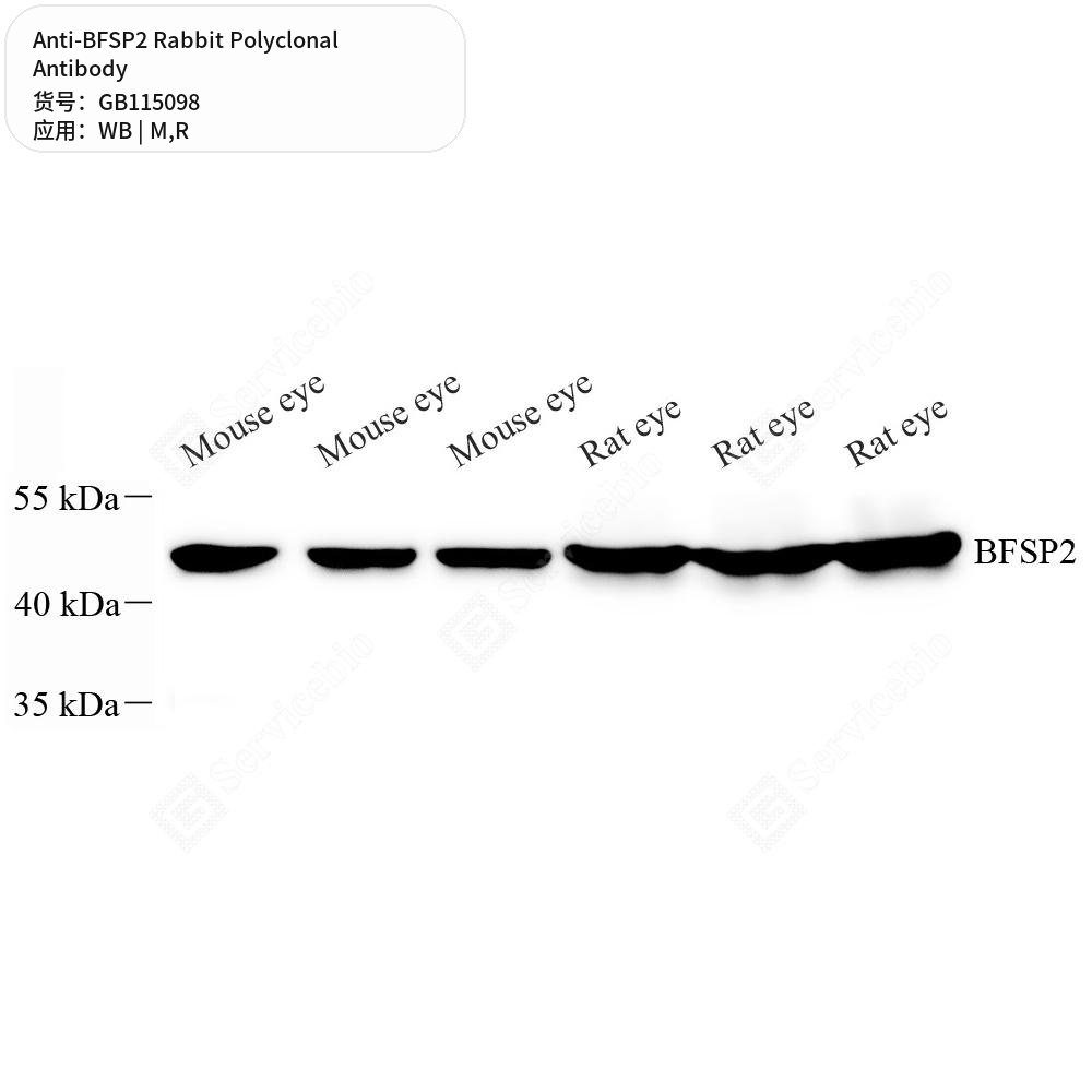 Антитела первичные, поликлональные кролика к BFSP2 крысы, мыши, 50 мкл