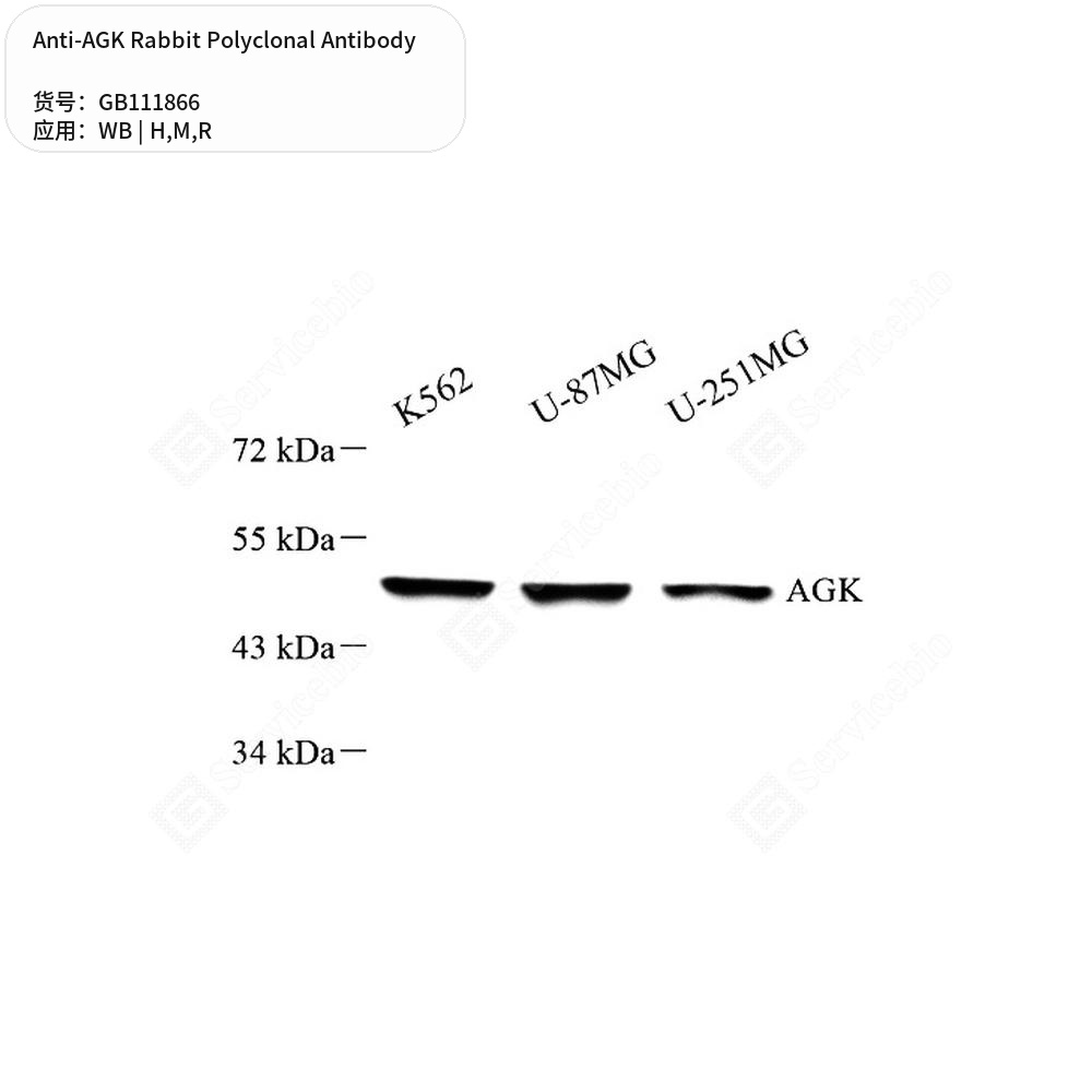 Антитела первичные, поликлональные кролика к AGK крысы, мыши, человека, 100 мкл
