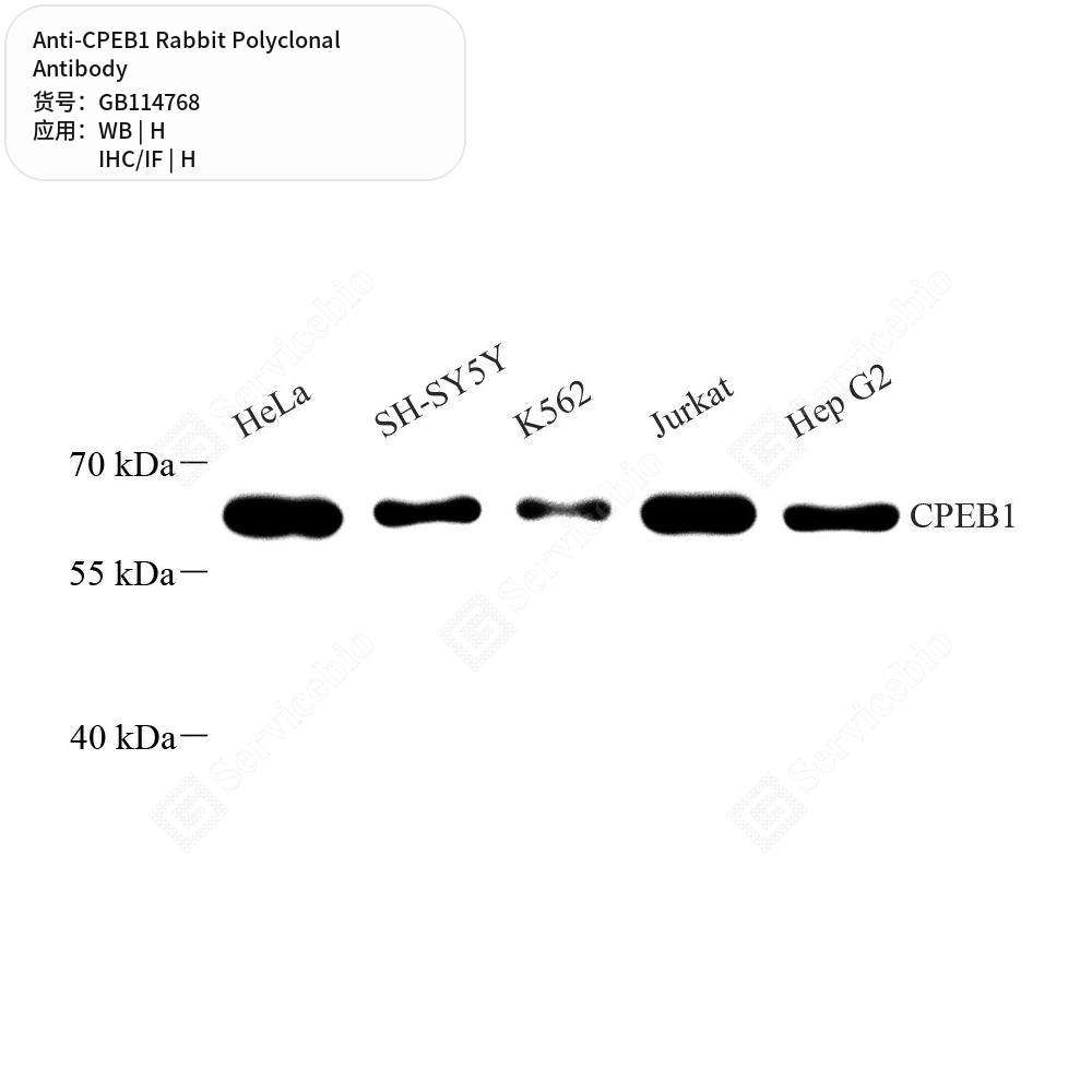 Антитела первичные, поликлональные кролика к CPEB1 человека, 100 мкл