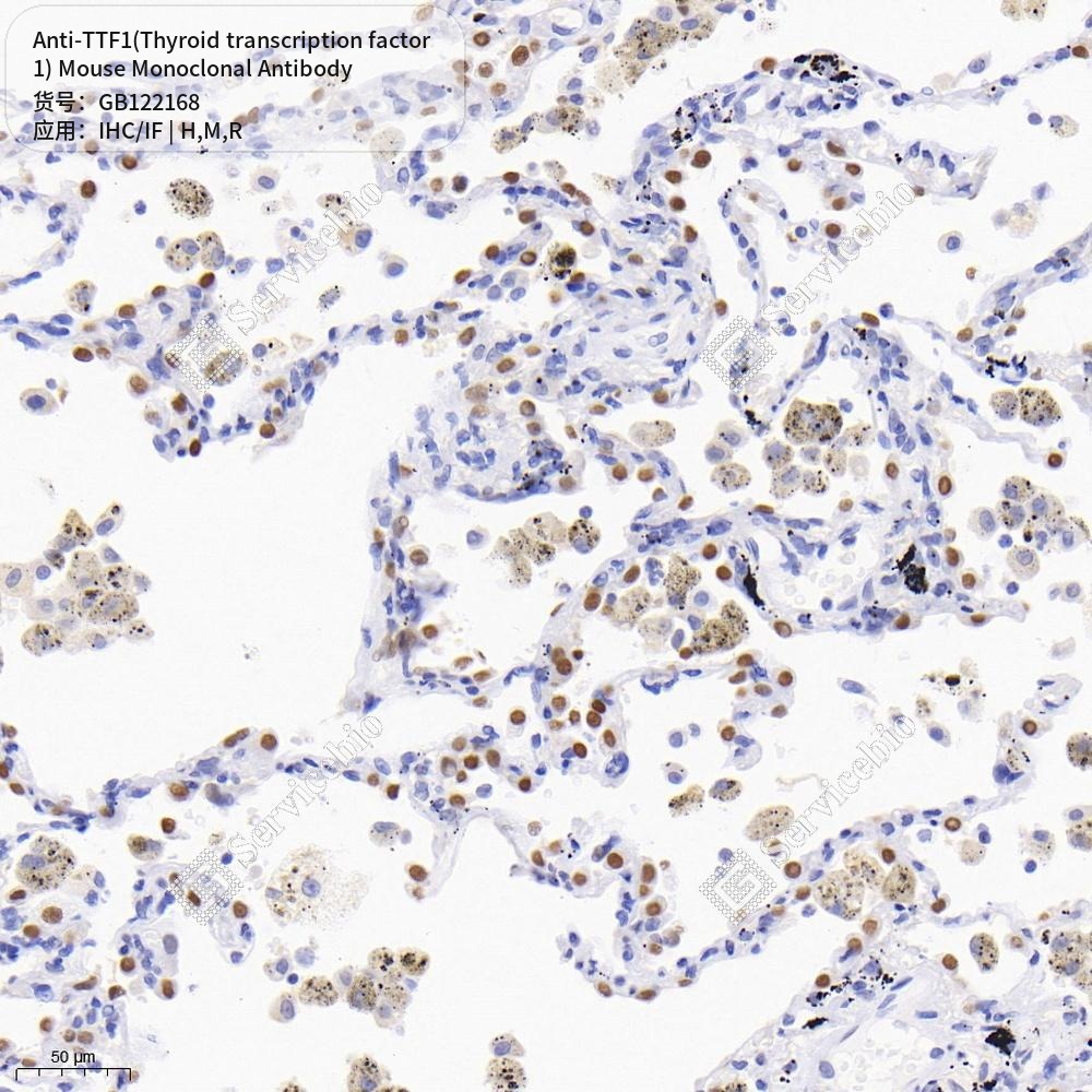 Антитела первичные, монок. мыши к TTF1(Thyroid transcription factor 1) крысы, мыши, чел., 50 мкл