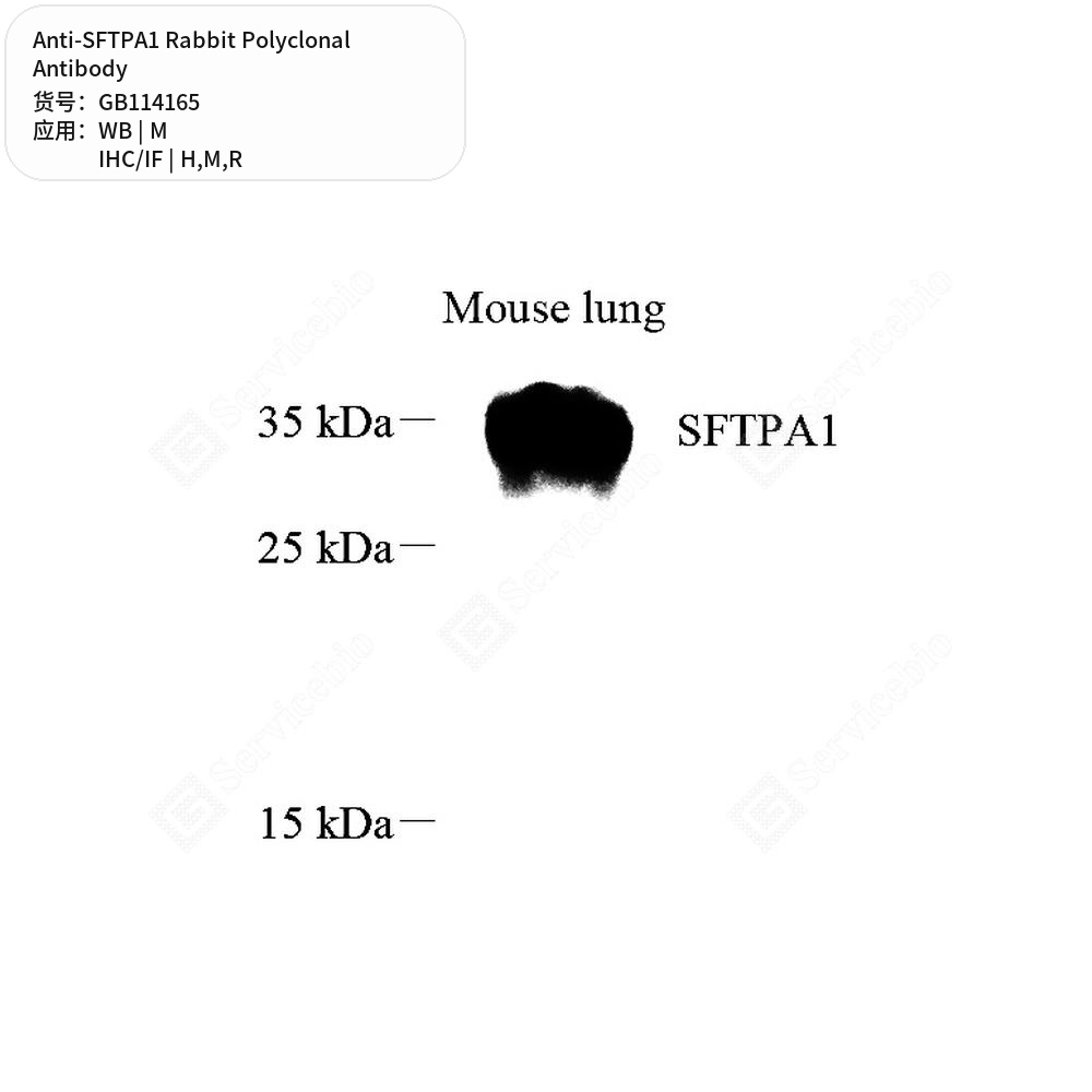 Антитела первичные, поликлональные кролика к SFTPA1 крысы, мыши, человека, 50 мкл