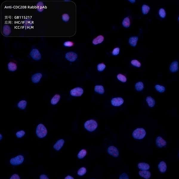 Антитела первичные, поликлональные, CDC20B, 100 мкл