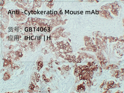 Антитела первичные, моноклональные мыши к Cytokeratin 6 человека, 50 мкл