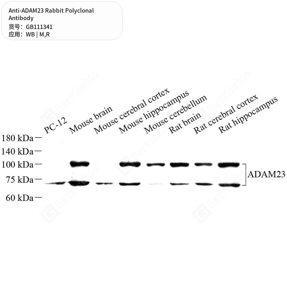 Антитела первичные, поликлональные кролика к ADAM23 крысы, мыши, 100 мкл