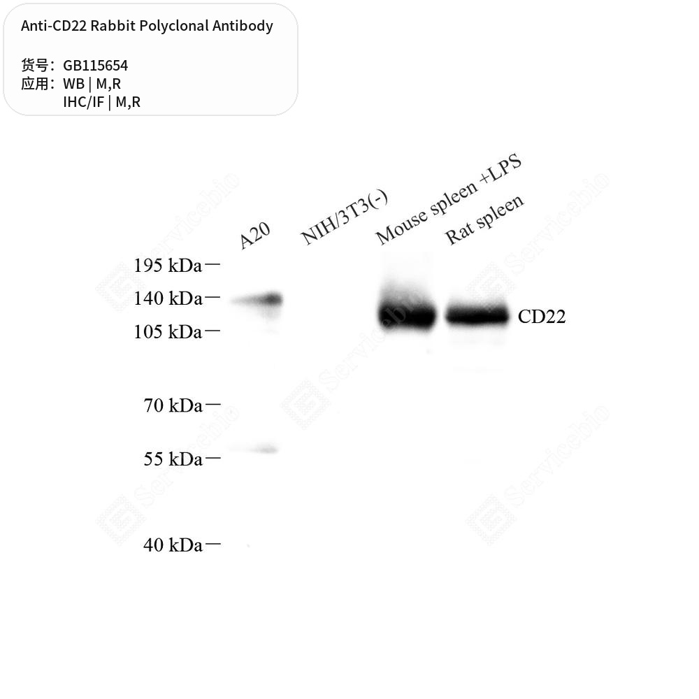 Антитела первичные, поликлональные кролика к CD22 крысы, мыши, 50 мкл