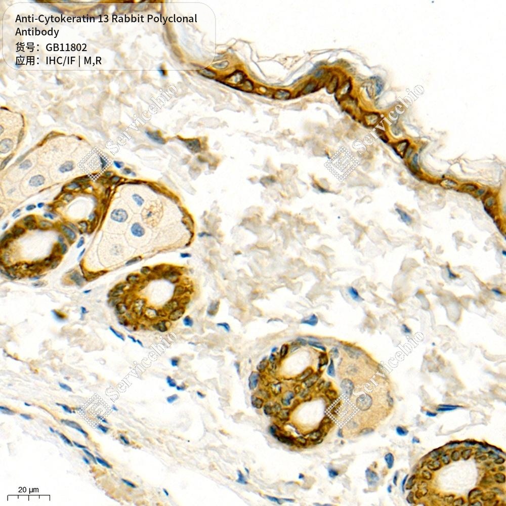 Антитела первичные, поликлональные кролика к Cytokeratin 13 крысы, мыши, 50 мкл