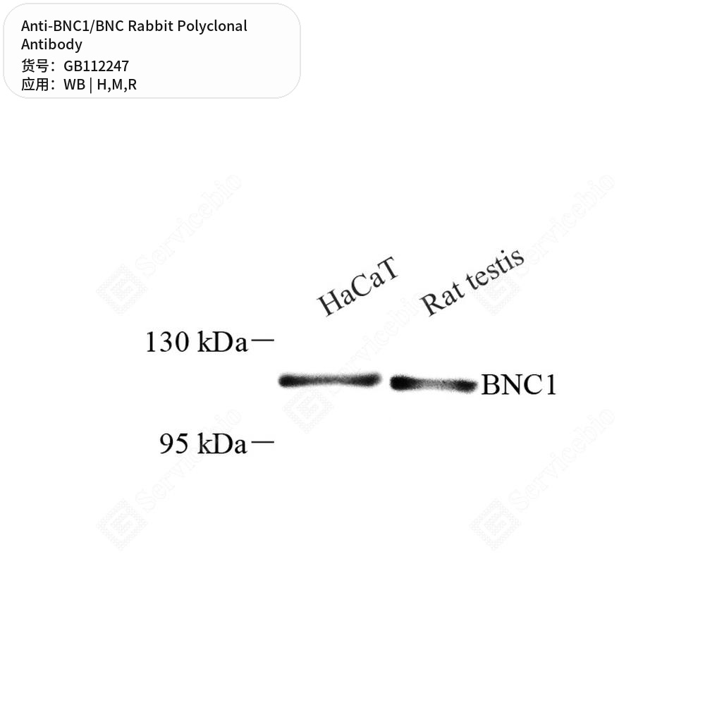 Антитела первичные, поликлональные кролика к BNC1/BNC крысы, мыши, человека, 100 мкл
