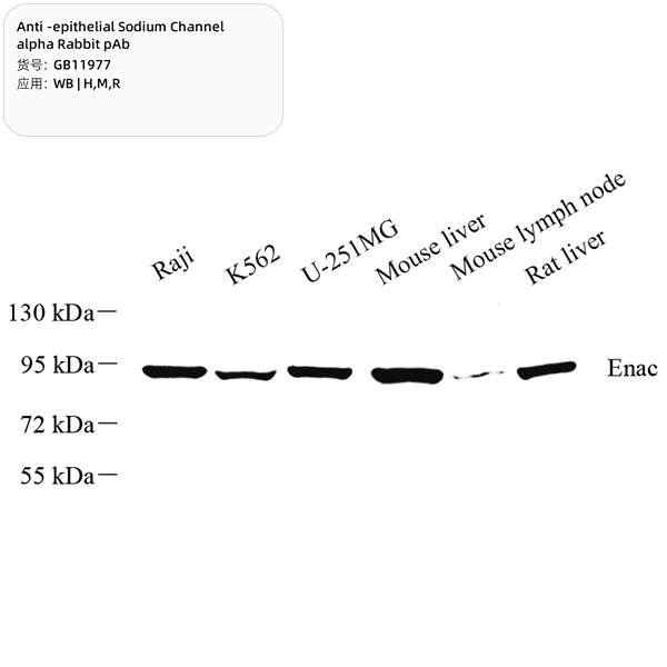 Антитела первичные, поликлональные, epithelial Sodium Channel alpha, 100 мкл