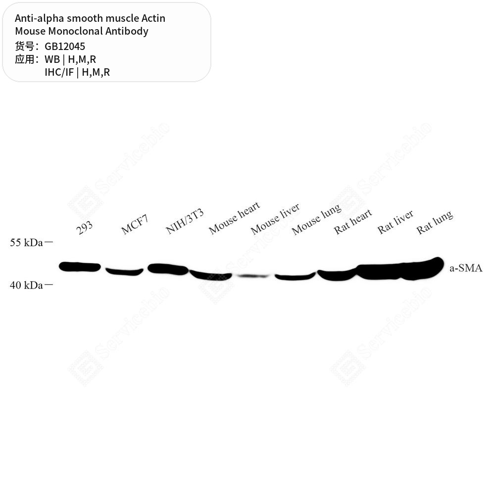 Антитела первичные, моноклональные мыши к alpha smooth muscle Actin крысы, мыши, человека, 50 мкл