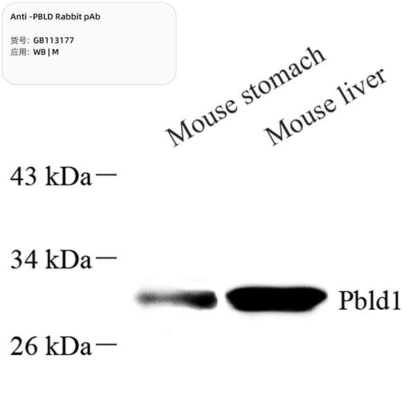 Антитела первичные, поликлональные, PBLD, 100 мкл