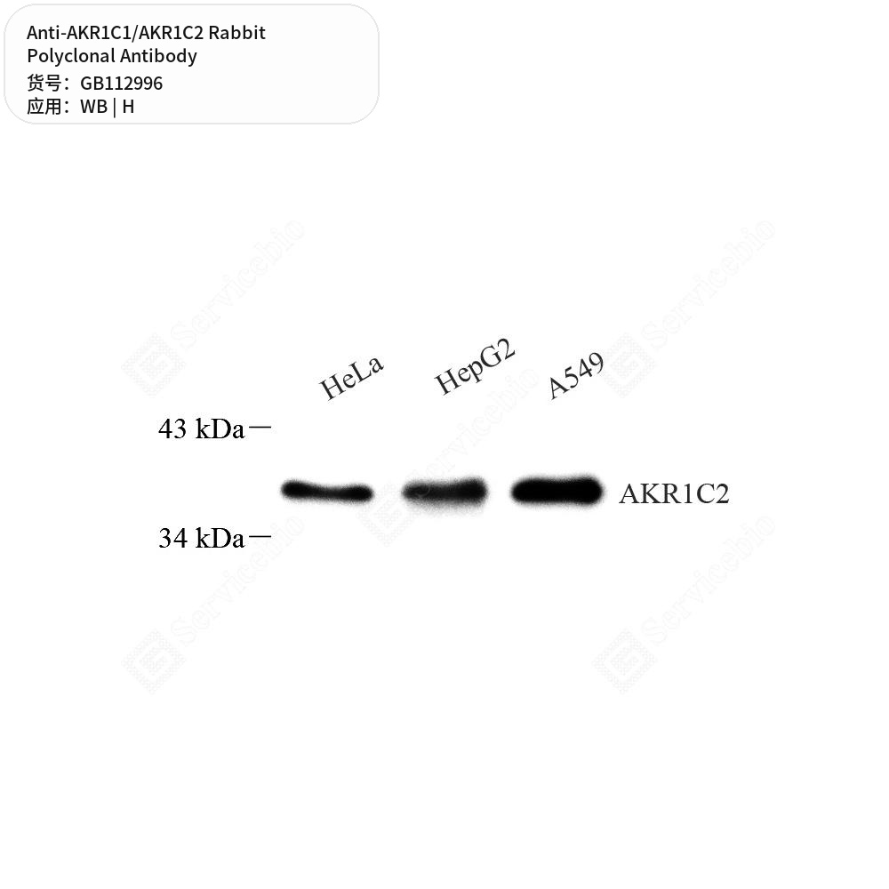 Антитела первичные, поликлональные кролика к AKR1C1/AKR1C2 человека, 100 мкл