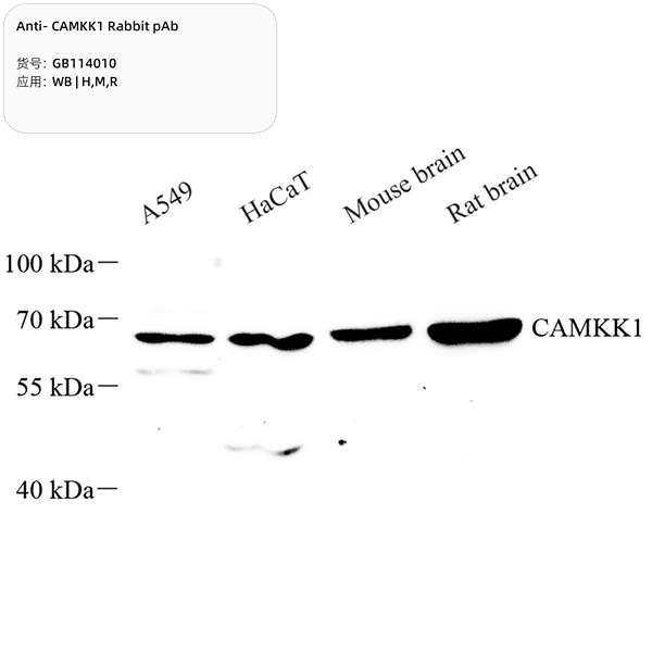 Антитела первичные, поликлональные, CAMKK1, 100 мкл