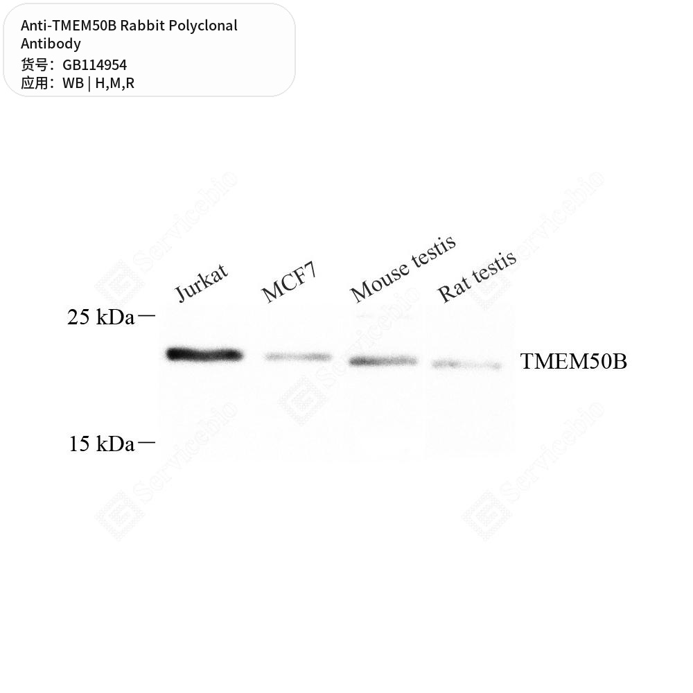 Антитела первичные, поликлональные кролика к TMEM50B крысы, мыши, человека, 50 мкл