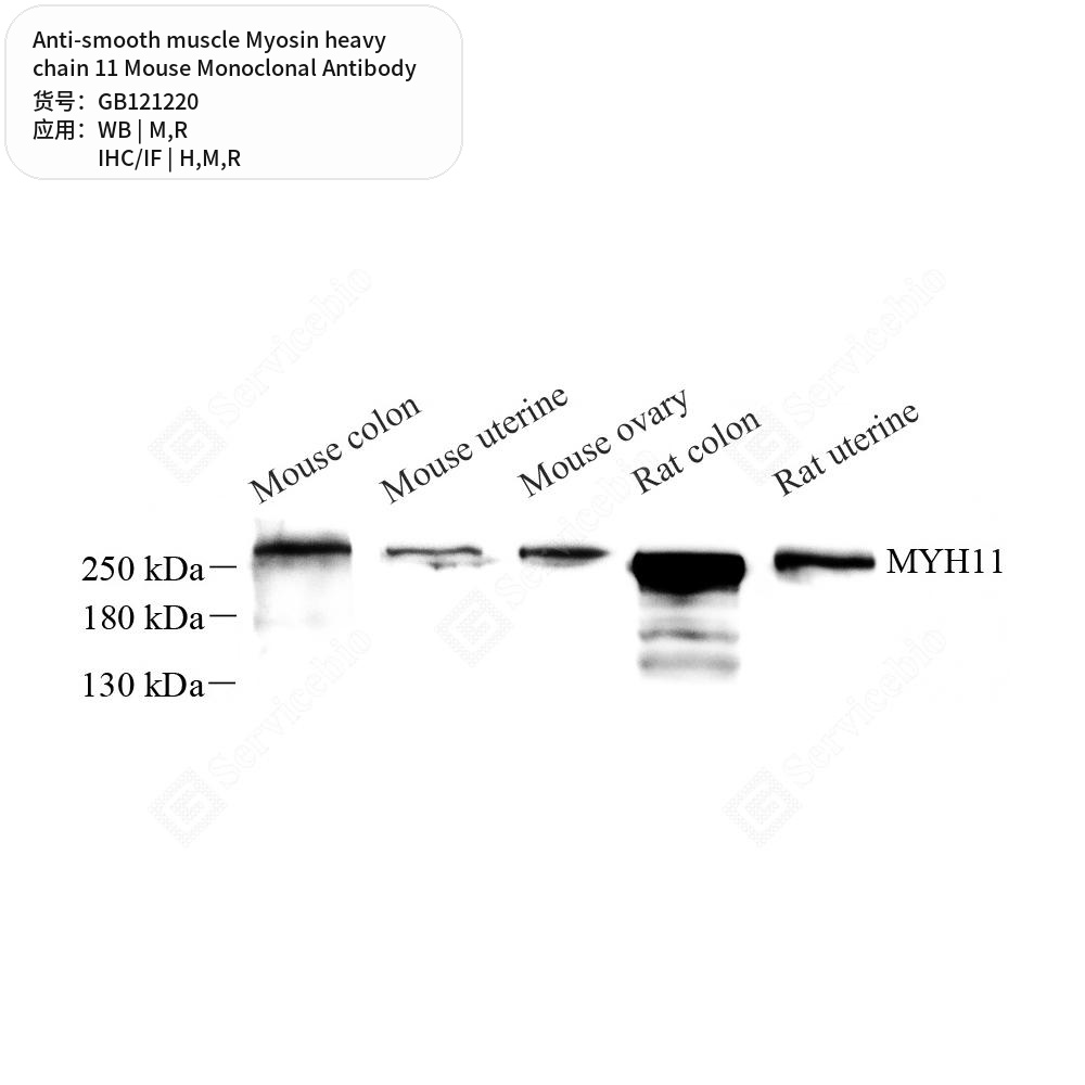 Антитела первичные, монок. мыши к smooth muscle Myosin heavy chain 11 крысы, мыши, чел., 50 мкл
