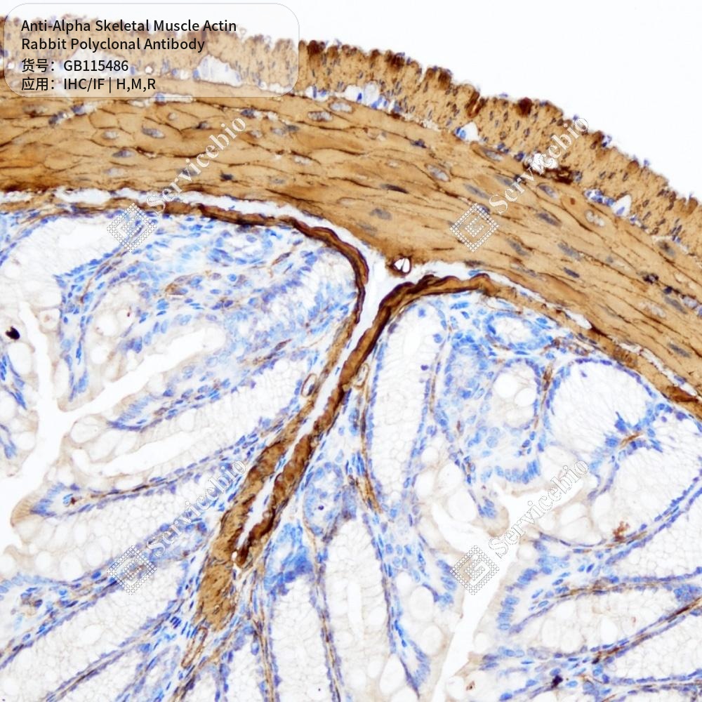 Антитела первичные, поликл. кролика к Alpha Skeletal Muscle Actin крысы, мыши, человека, 100 мкл