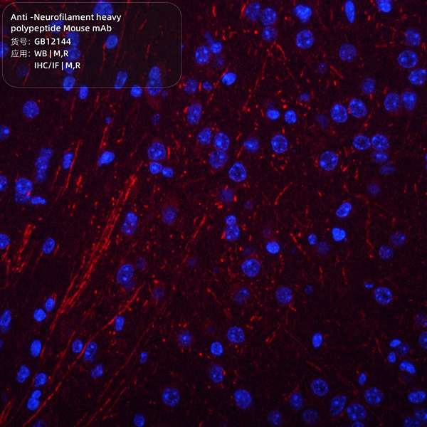 Антитела первичные, моноклональные, Neurofilament heavy polypeptide, 100 мкл