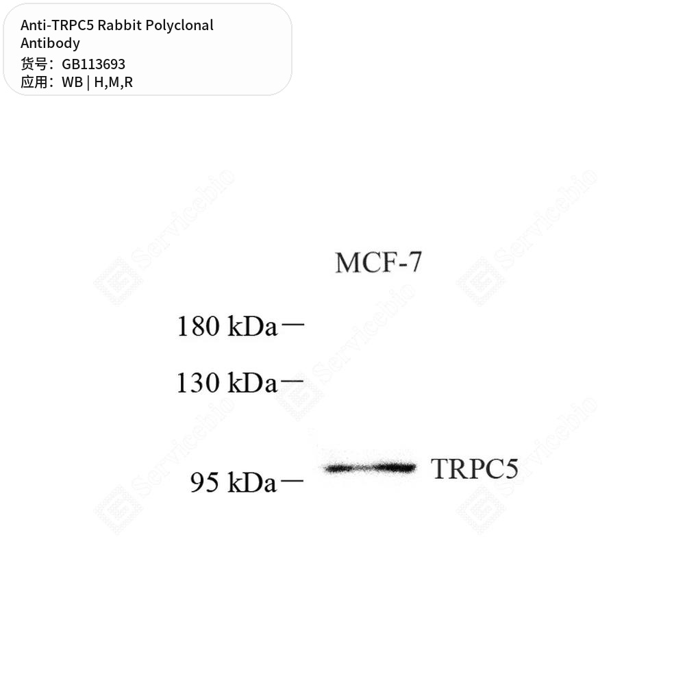 Антитела первичные, поликлональные кролика к TRPC5 крысы, мыши, человека, 100 мкл
