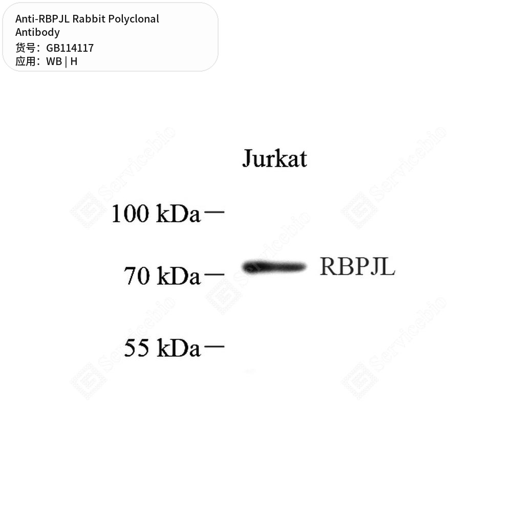 Антитела первичные, поликлональные кролика к RBPJL человека, 100 мкл