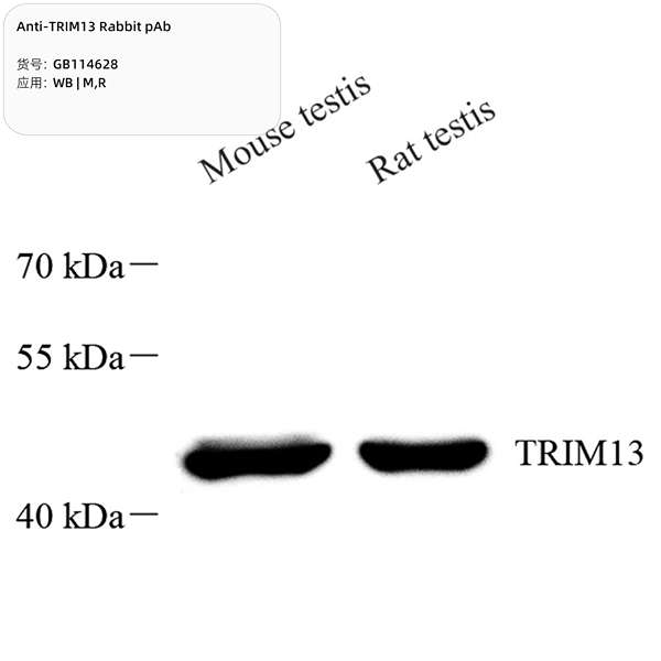 Антитела первичные, поликлональные, TRIM13, 100 мкл