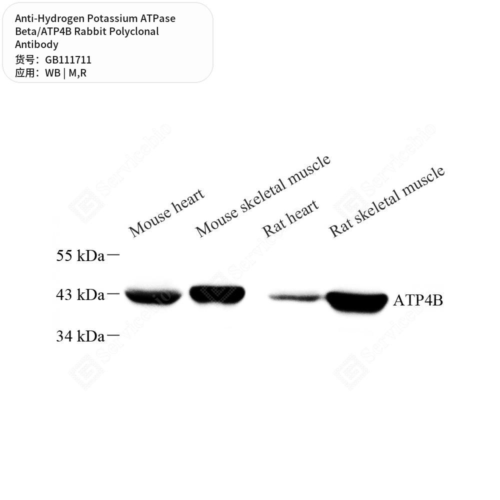 Антитела первичные, поликл. кролика к Hydrogen Potassium ATPase Beta/ATP4B крысы, мыши, 100 мкл