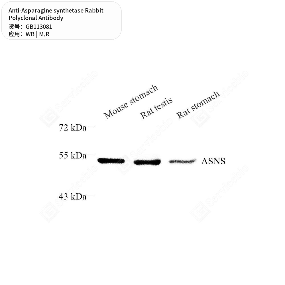 Антитела первичные, поликлональные кролика к Asparagine synthetase крысы, мыши, 50 мкл
